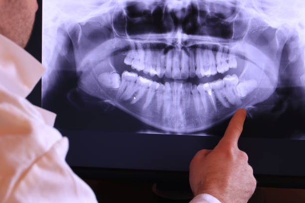 Best Emergency Denture Repair in Mount Carmel, TN