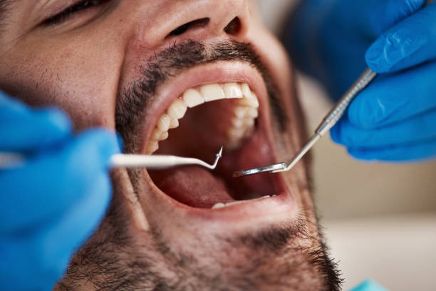 Best Emergency Gum Treatment in Mount Carmel, TN